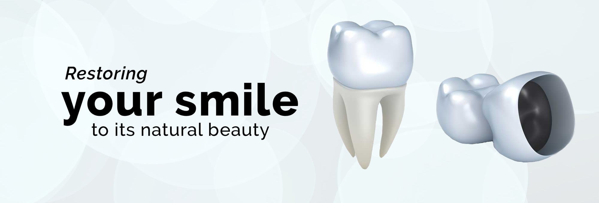 Restore your smile with Dental Crowns