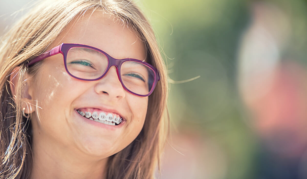 Dental Braces in San Diego