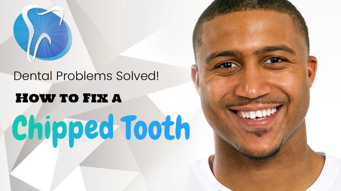 Have You Cracked a Smile Lately? 4 Ways to Fix a Chipped Tooth Fast